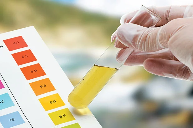 kesehatan warna urine